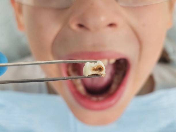 Best Emergency Treatment for Oral Infections in Brockway, PA